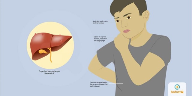 penyakit hepatitis a